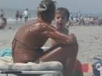 5c2_sunburn.jpg