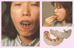 detachable tooth covers.jpg