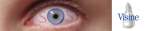 visine_sos.jpg