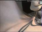 implant4.jpg