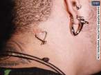 neckscar.jpg