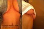 burn-bra-21.jpg